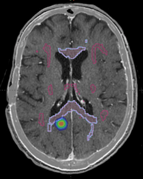 brain pic